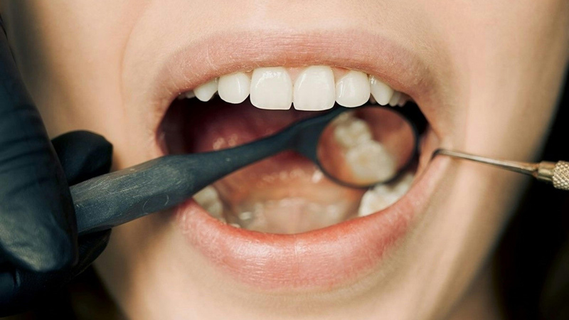 ortopedia funcional dos maxilares, Unique Smile